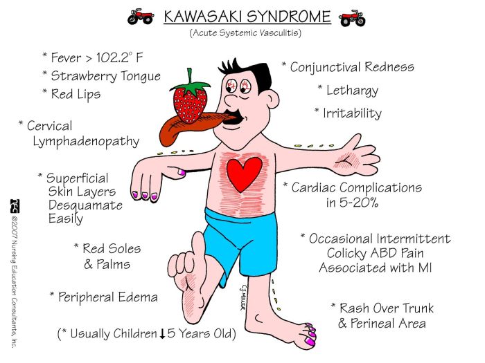 Kawasaki disease nursing care plan